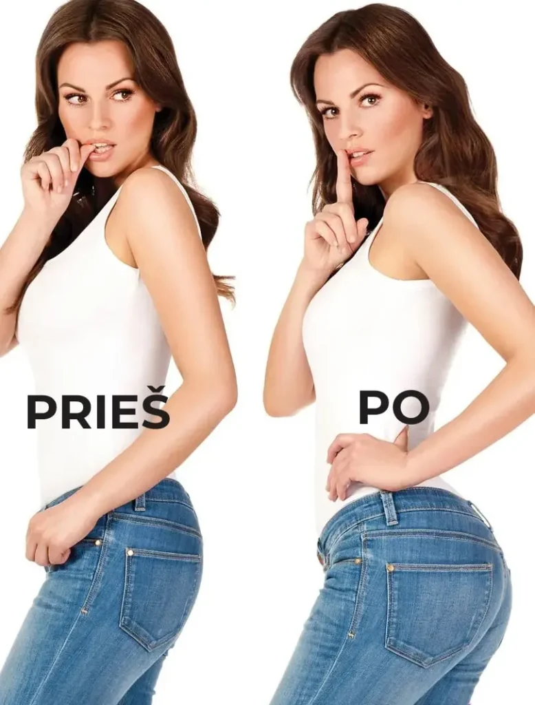 sėdmenis pakeliantys apatiniai